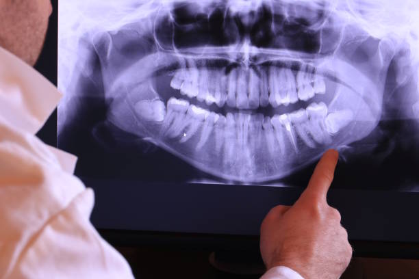 Best Tooth Infection Emergency Dentist  in Burbank, WA