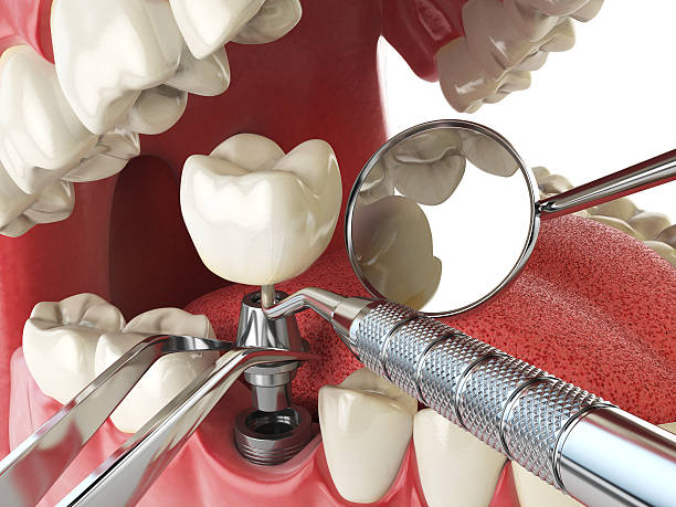 Best Tooth Pain Emergency Relief  in Burbank, WA