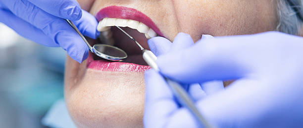 Best Emergency Dental Filling Replacement  in Burbank, WA